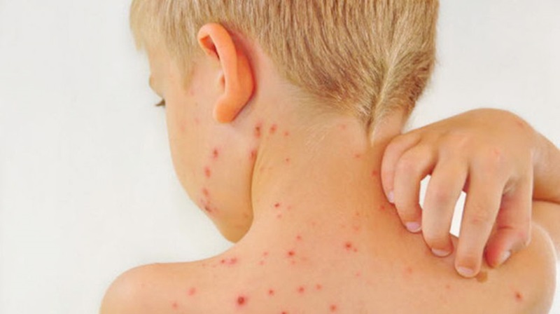 Irritation in children under 6 years old